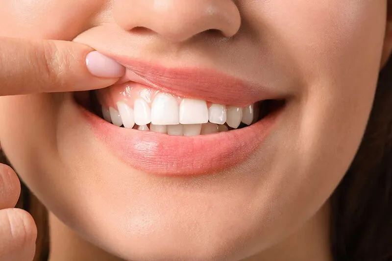 gum surgery cost in gurgaon