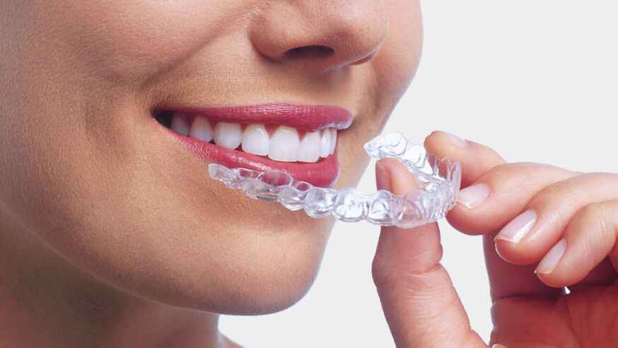 invisible braces cost in gurgaon