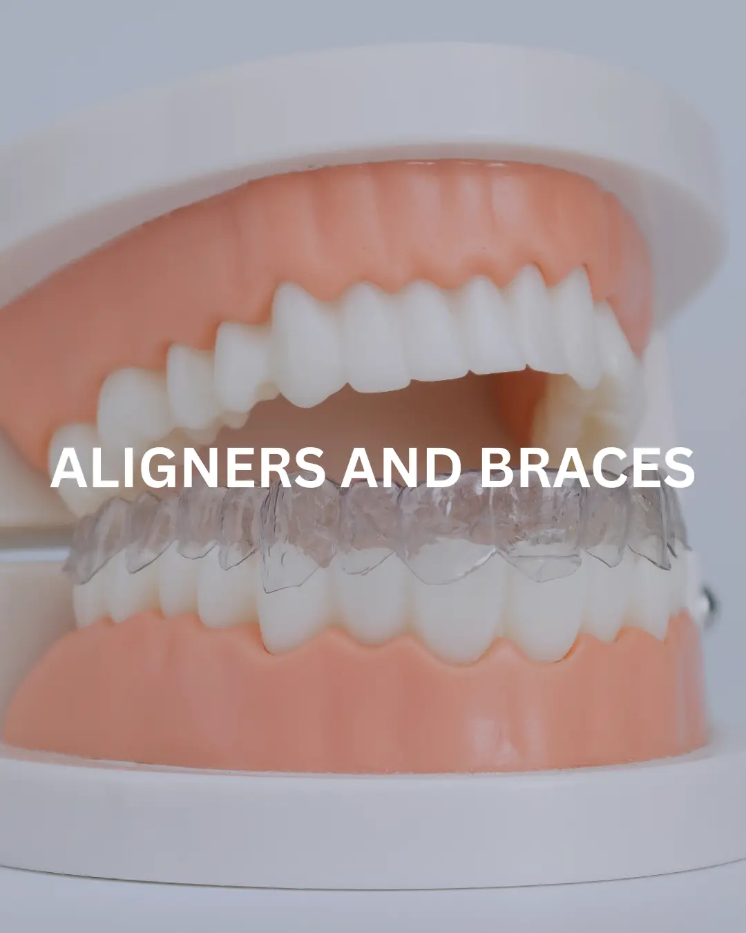 Braces & Aligners